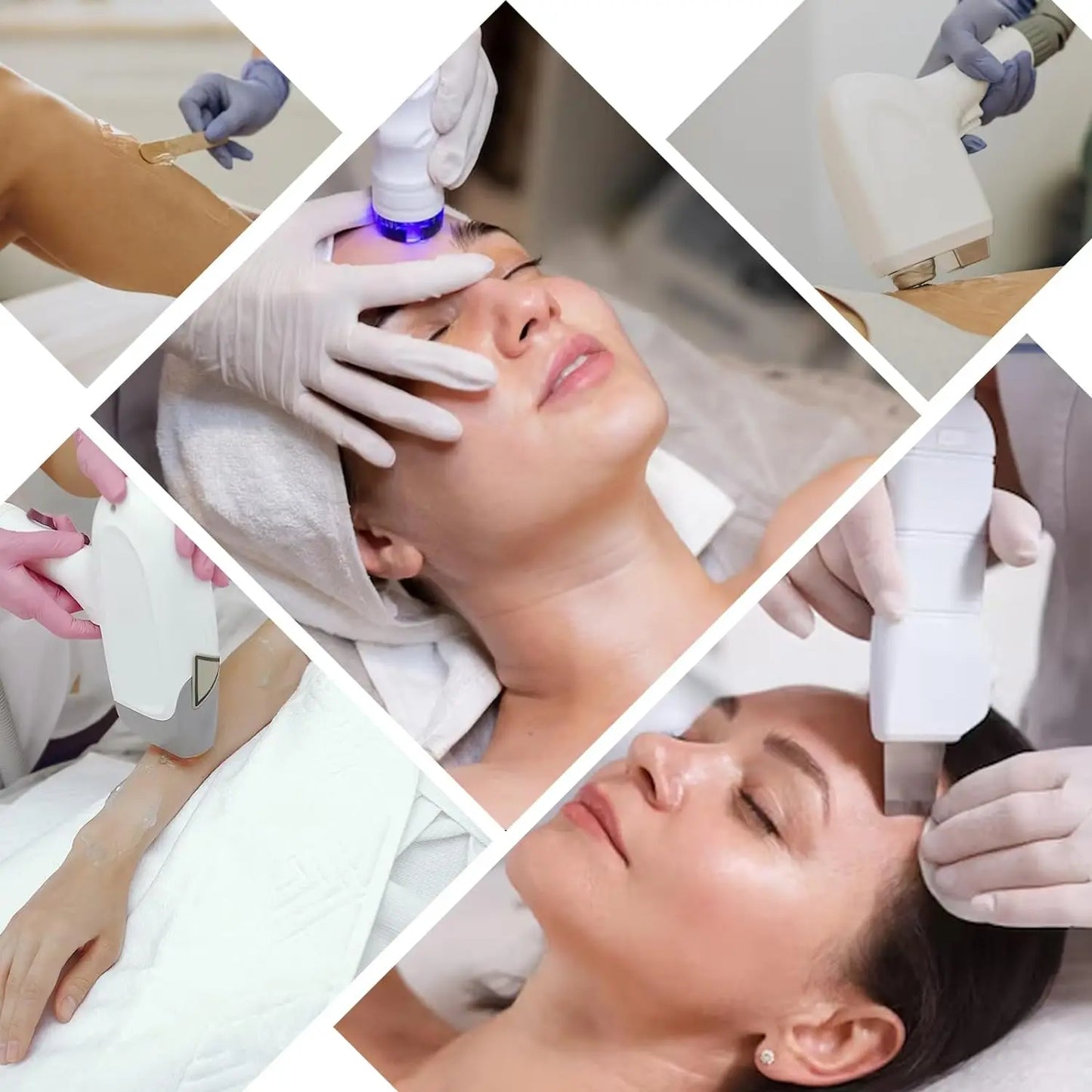 YMEYFAN Hyaluronic Acid Cooling Gel For IPL Laser Hair Removal